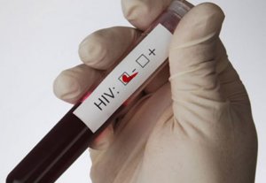 В Крыму нет ни одного экспресс-теста на ВИЧ-СПИД, - главный санитарный врач РФ