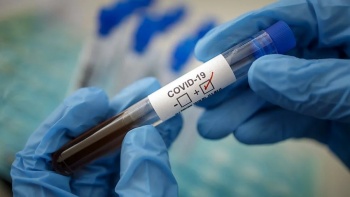 Роспотребнадзор разработал высокоточный тест на коронавирус