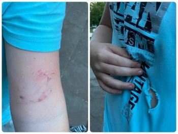Следком Крыма начал проверку из-за нападения собаки на игравшего на детской площадке ребенка