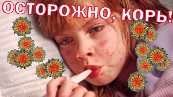 В Крыму зафиксировали первый в этом году случай кори